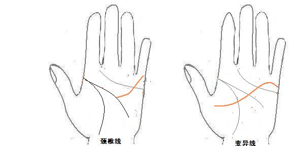 从手型看健康