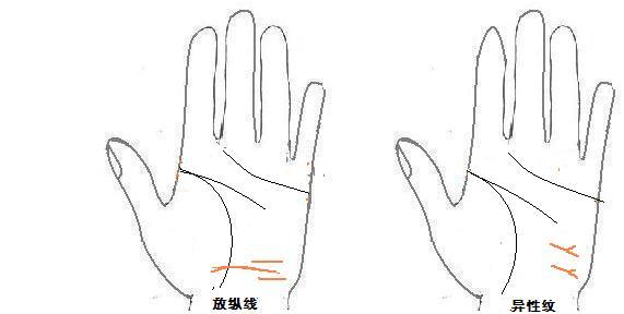 从手型看健康