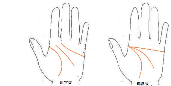 从手型看健康