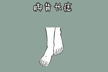 脚背上长痣代表什么