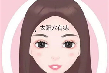 开运痣在哪里