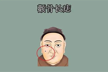 颧骨上的痣是什么意思