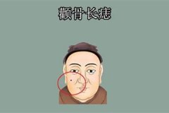 颧骨上的痣是什么意思