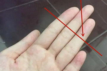 小拇指短代表什么意思